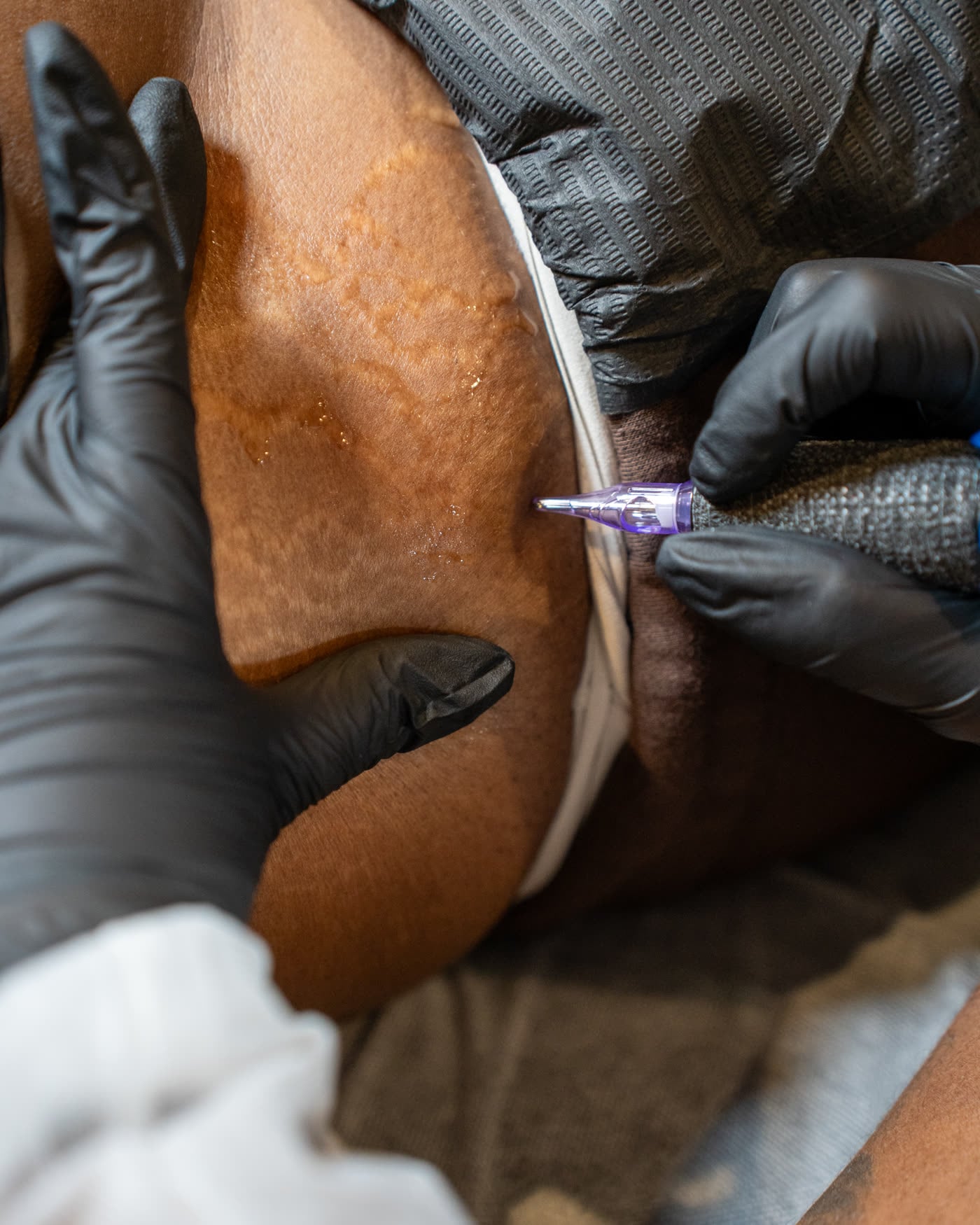 Pigment placed on scar tissue during training